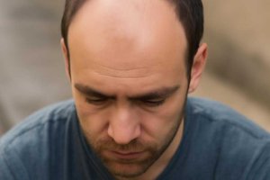 Как я работаю с выпадением волос и возрастными изменениями кожи