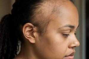 Тайна распущенных прядей: медицинский взгляд