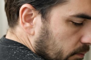 Кошачья перхоть в волосах и реакция кожи головы