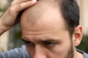 Как остановить выпадение волос и вернуть им плотность